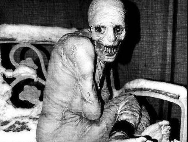 Black-and-white image depicting a disturbing figure often associated with the fictional Russian Sleep Experiment. The emaciated, skeletal figure has hollow eyes, a twisted grin, and sits in a contorted position, creating a haunting, unsettling appearance.