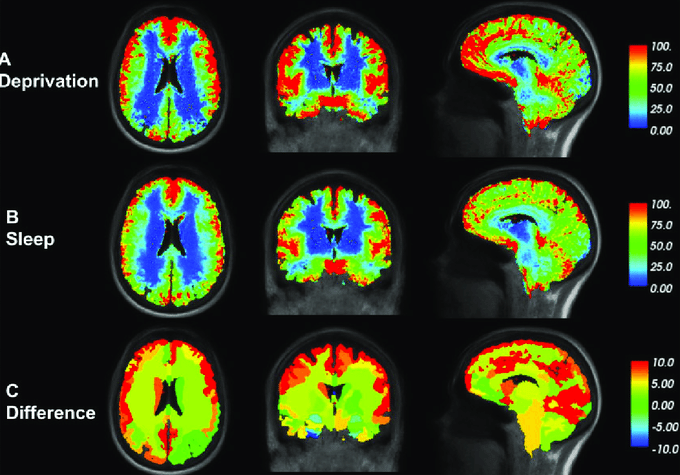 Three rows of brain scans showing brain activity in different states. Row A (Deprivation) shows brain activity during sleep deprivation, with high activity in red and low in blue. Row B (Sleep) displays brain activity during normal sleep with similar color coding. Row C (Difference) highlights changes in brain activity between sleep and deprivation. A color scale on the right represents activity levels from 0 to 100.